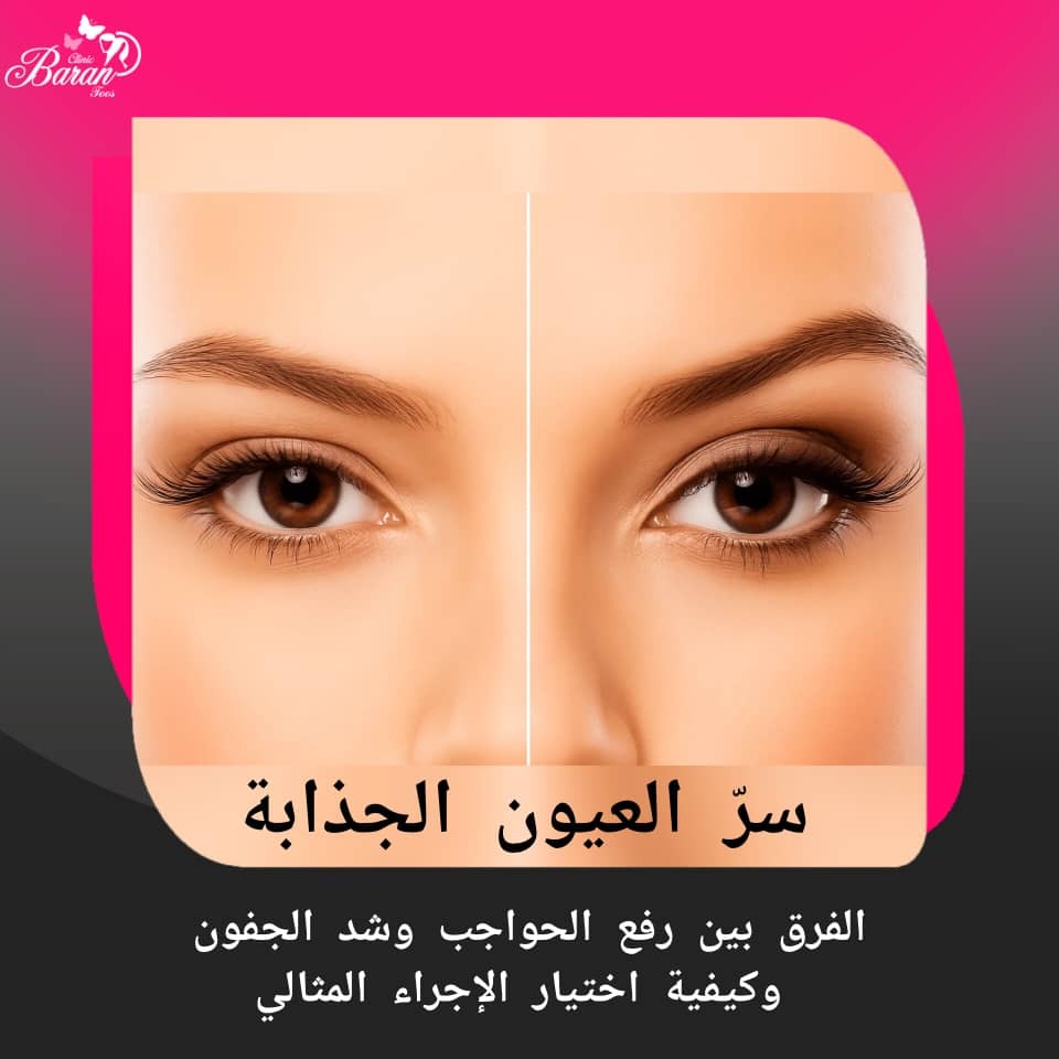 رفع الحواجب وشد الجفون: دليل باران توس للحصول على عيون أكثر إشراقاً وشباباً